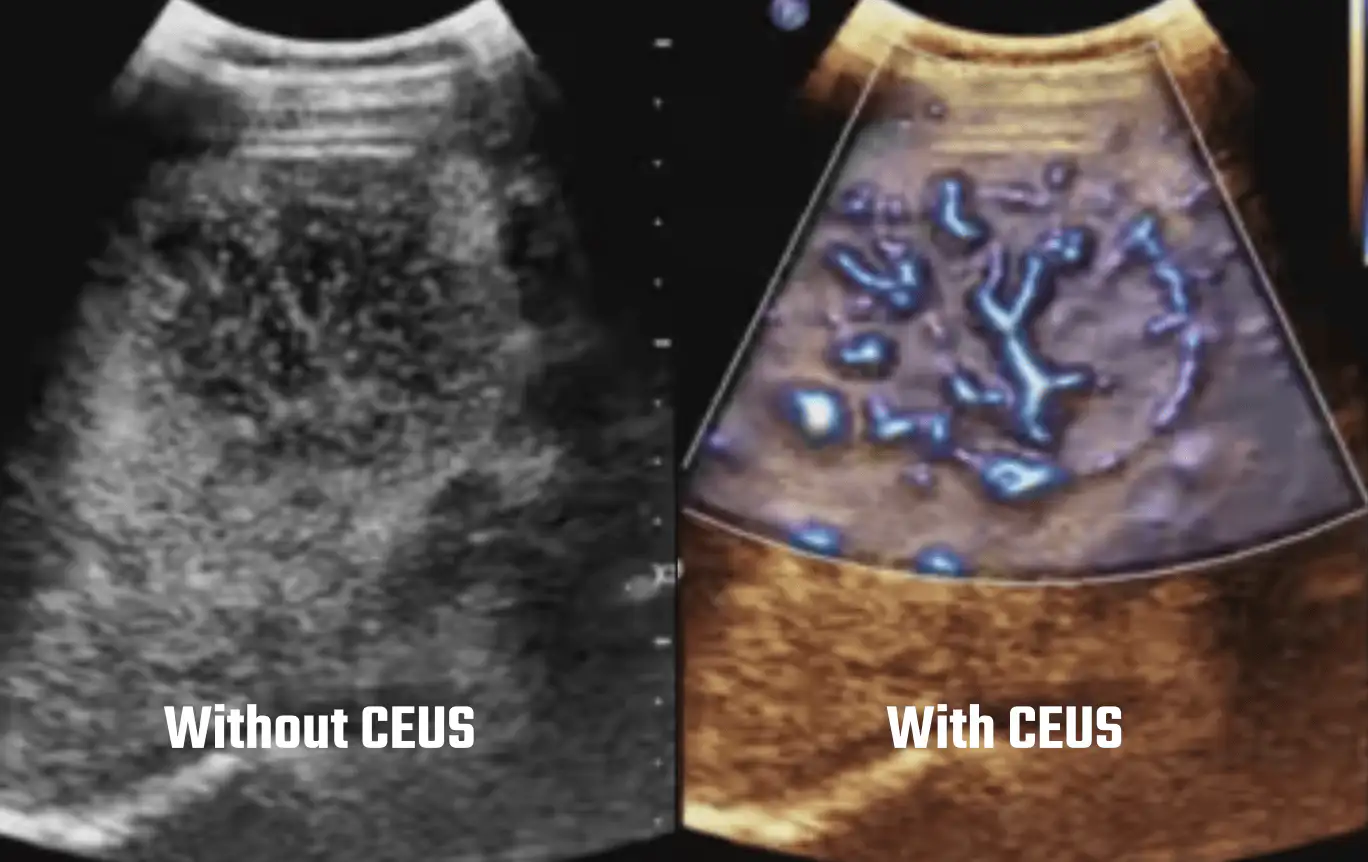 Two ultrasound images