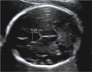 fetal-ultrasound.jpeg