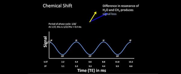 chemical-shift.jpeg