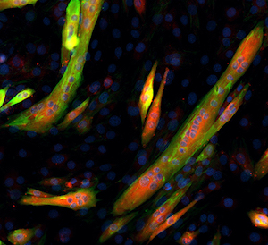 Researchers have discovered a tiny protein (shown in red) required for developing muscle progenitors to fuse and form contracting muscle fibers. Image by Qiao Zhang.